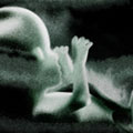 Babyphoto im Ultraschall